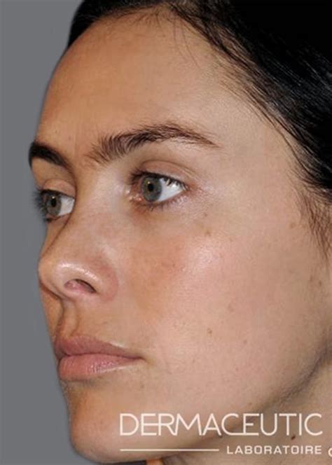 skin peel ballito|Home [www.skindoctor.co.za].